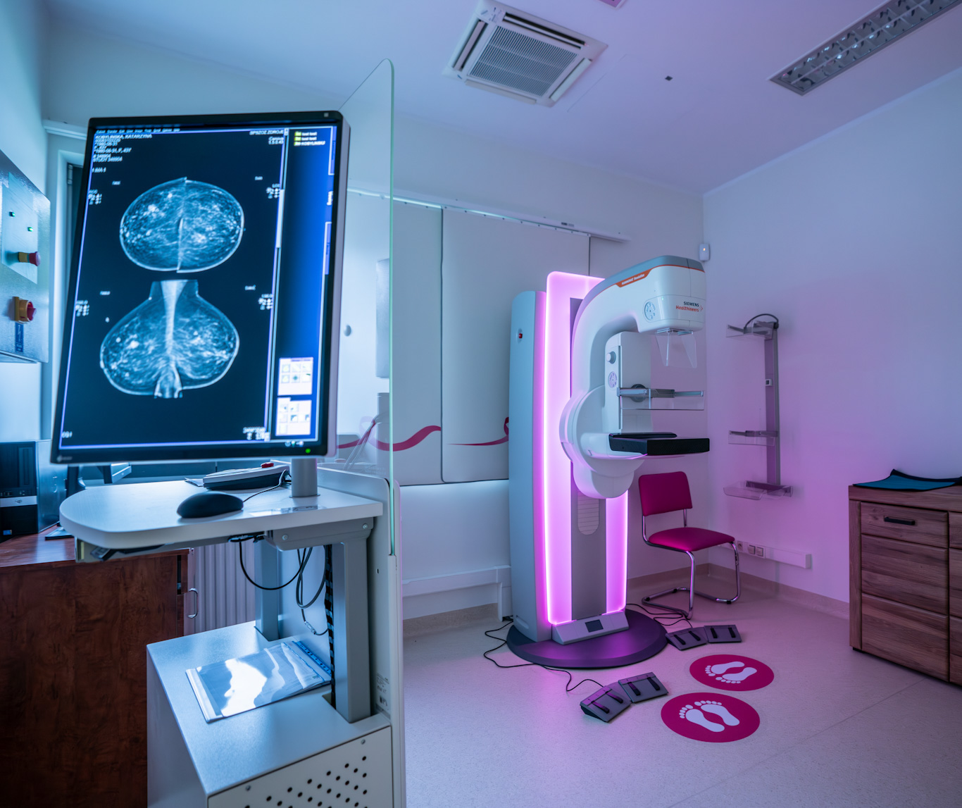 mammografia 3 edited