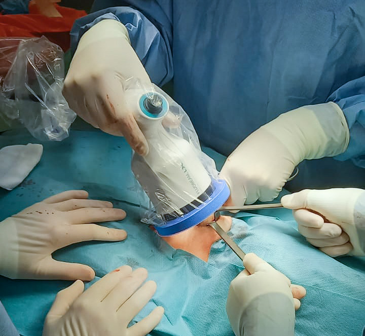 Rak tarczycy w Oddziale Chirurgii Klinicznej ZCO 8 tarczyca 1 edited